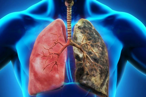 O cigarro te sufoca: os impactos do tabagismo na sua respiração